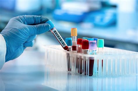 new blood test for parkinson's disease